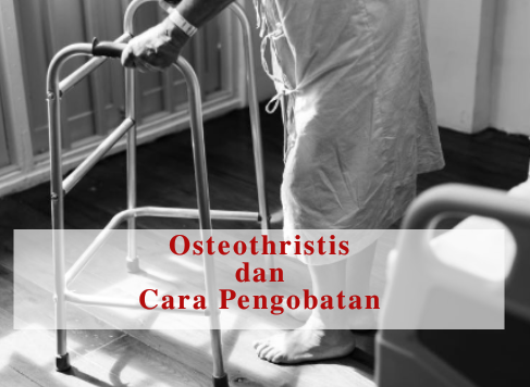 Pengobatan osteoarthristis